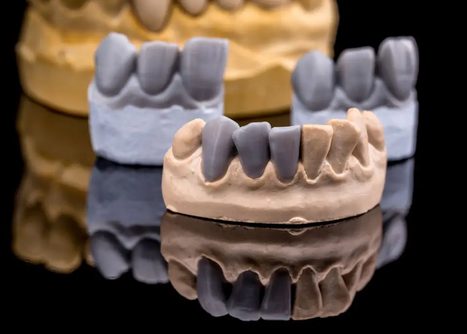 What are the benefits of a diagnostic wax-up?